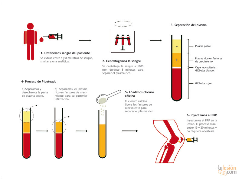 La rodilla de la mujer joven - Clínica Traumatológica Doctor Antonio Ríos